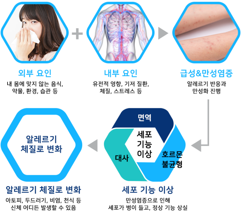 알레르기 | 위드유 의원, 한의원